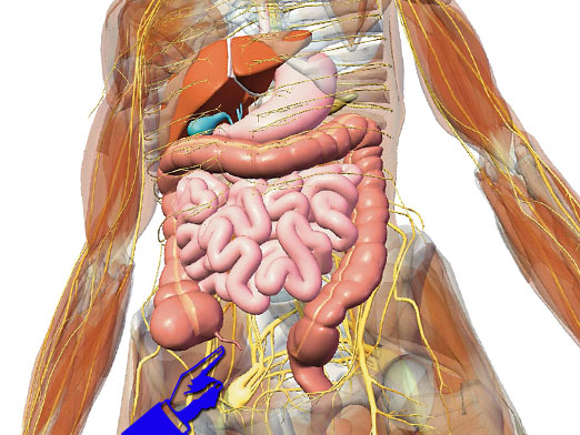 Waar bevindt appendicitis zich?